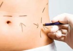 cirurgia-plastica-patos-de-minas-1353288601