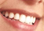 implantes-dentarios-patos-de-minas-1353432916